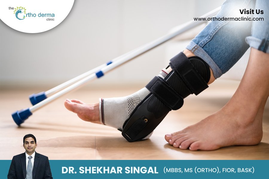 Expert Foot and Ankle Surgery at Orthoderma Clinic