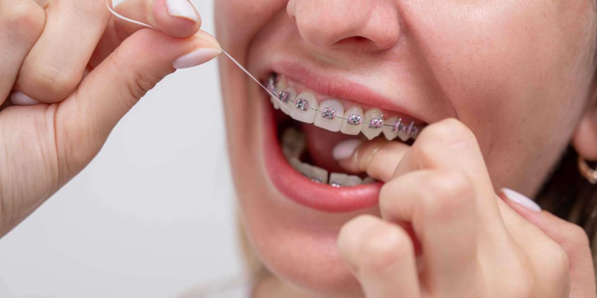 Why 3/4 Manchester Adults Choose Invisalign Over Braces