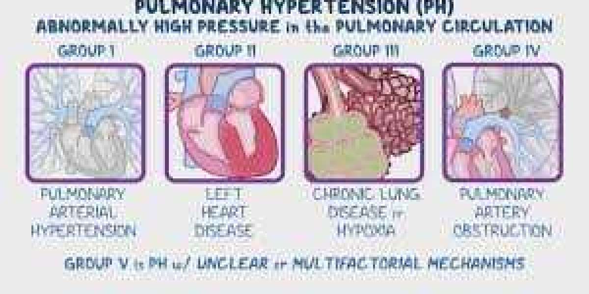 Breaking Down Pulmonary Hypertension