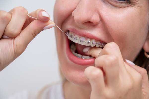 orthodontist Lancaster